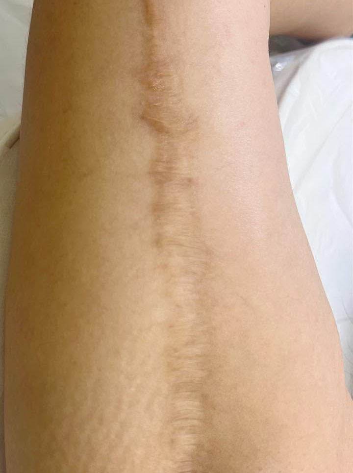 Image 4 after
