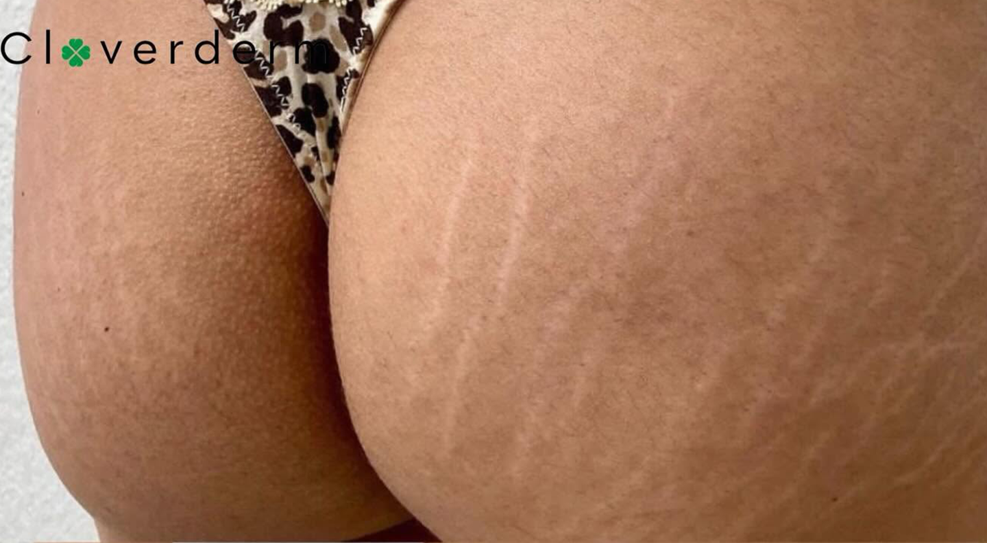 Marks Before 3