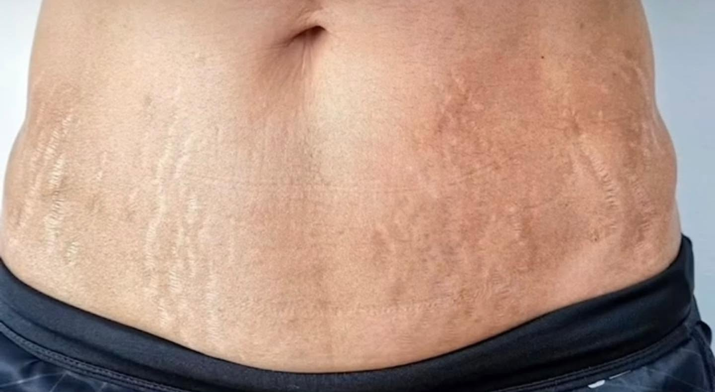Marks Before